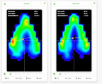 Saddle Pressure Mapping