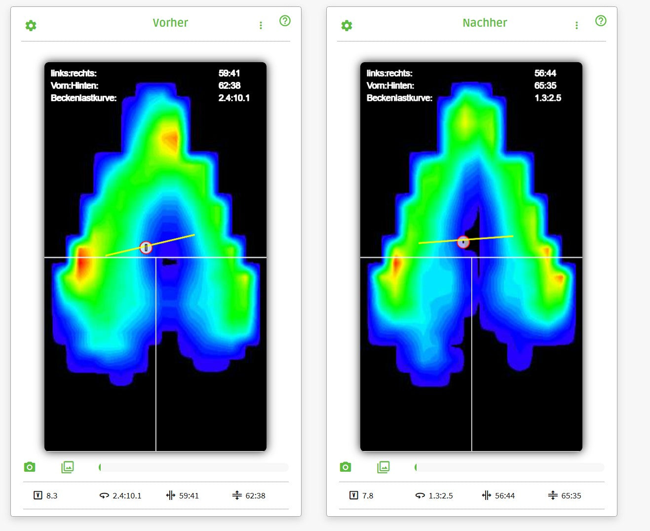 Saddle Pressure Mapping
